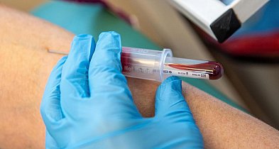 Zwykły test krwi może wskazać ryzyko zawału-9192