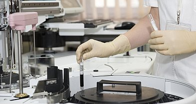 Ekspert: badanie stężenia cholesterolu u dzieci może zapobiec zawałom i przedwczes-16697