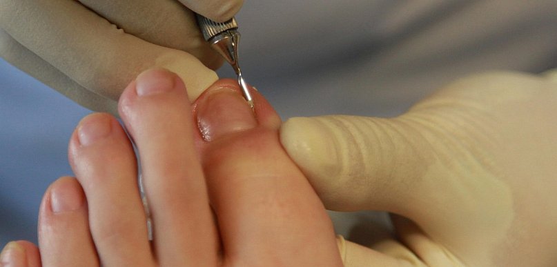 Psycholog: obgryzanie paznokci i prokrastynacja wynikają z instynktów przetrwania